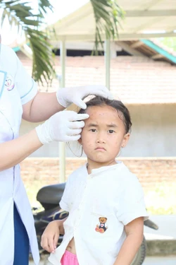 Chủ động phòng, chống dịch bệnh thủy đậu tại trường học