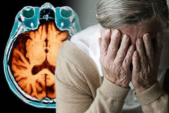 Lối sống lành mạnh giúp làm chậm tình trạng suy giảm trí nhớ