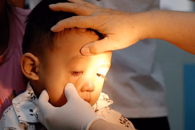 Nhiều người bị đau mắt đỏ, Sở Y tế Thành phố Hồ Chí Minh truy tìm tác nhân gây bệnh ảnh 2