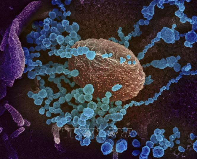Hình ảnh nhìn qua kính hiển vi cho thấy virus SARS-CoV-2 (vật thể tròn màu xanh) nổi lên trên bề mặt tế bào bệnh nhân nhiễm COVID-19. Ảnh: AFP/TTXVN Phát hiện vùng khí hậu tối ưu đối với virus SARS-CoV-2 ảnh 1