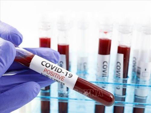 Mỹ đạt bước tiến mới trong phát hiện kháng thể chống virus SARS-CoV-2