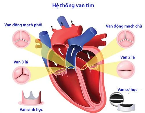 Cứu sống bệnh nhi mắc hội chứng Ehlers-Danlos hiếm gặp