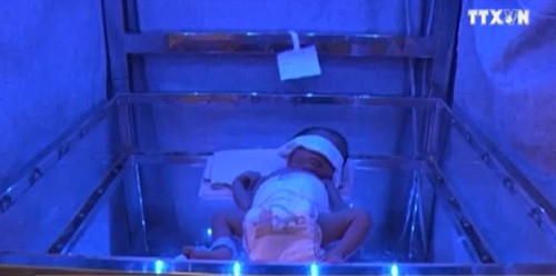 Giúp sản phụ "quá khổ" nặng 140kg sinh con an toàn