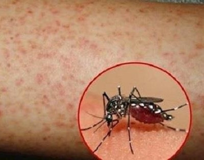 Số ca mắc sốt xuất huyết ở Đắk Lắk tăng hơn 40 lần so với cùng kỳ 2018