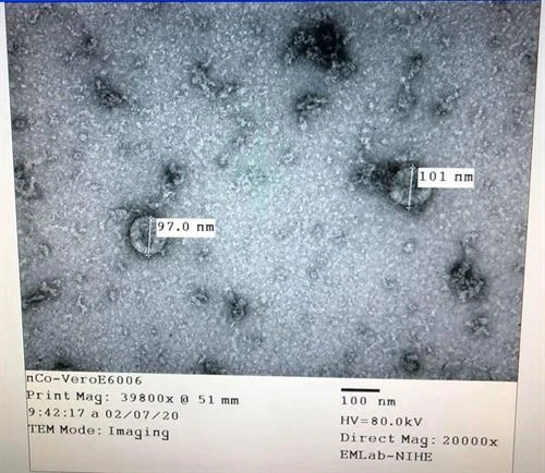 Sẽ sớm có kết quả thử nghiệm kit thử nhanh chủng virus Corona mới trên mẫu bệnh phẩm thực