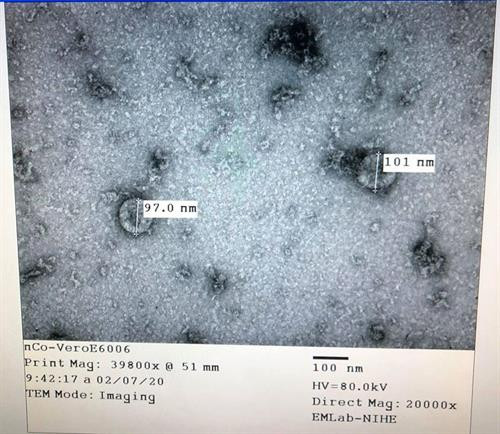 Sẽ sớm có kết quả thử nghiệm kit thử nhanh chủng virus Corona mới trên mẫu bệnh phẩm thực