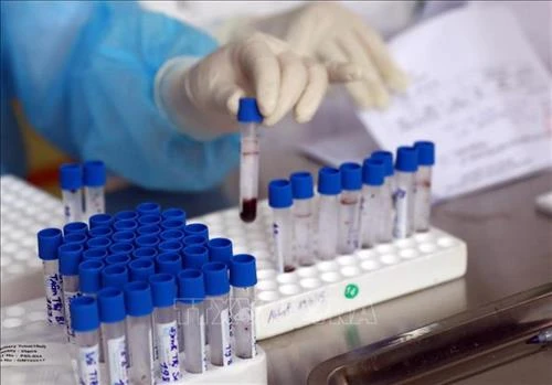 Dịch COVID-19: Chuyên gia lý giải về trường hợp tái dương tính với virus SARS-CoV-2