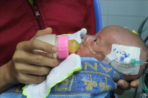 Phẫu thuật tim hở cho bệnh nhi nhẹ cân nhất từ trước đến nay
