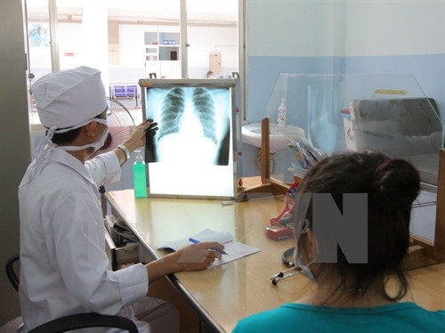 Bước đột phá trong điều trị lao kháng thuốc