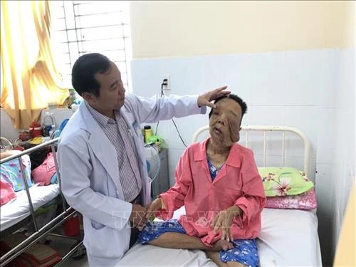 ​Phẫu thuật loại bỏ hai khối u thần kinh khổng lồ trên mặt nữ bệnh nhân