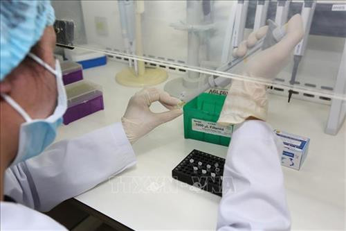 Dịch COVID-19: Tập trung nguồn lực chủ động sản xuất bộ xét nghiệm virus SARS-CoV-2