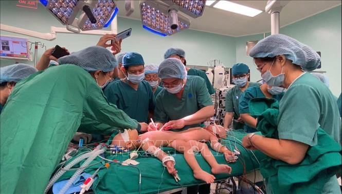 Bước đầu tách rời thành công cặp song sinh dính liền nhau