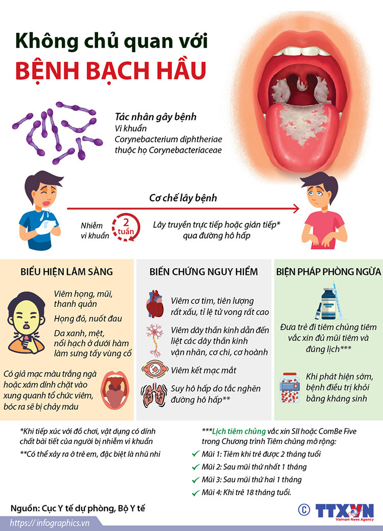 Không chủ quan với bệnh bạch hầu.Ảnh: Cục y tế dự phòng.