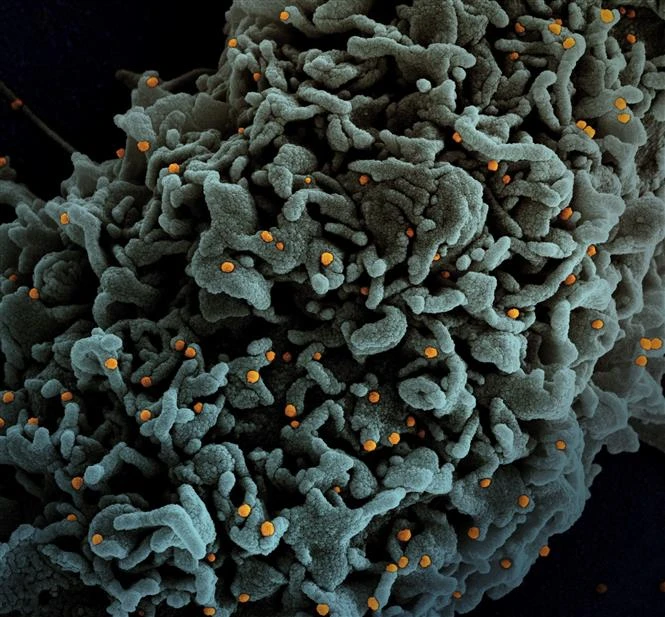 Hình ảnh quét qua kính hiển vi điện tử cho thấy tế bào (màu xanh) bị virus SARS-COV-2 (màu cam) xâm nhập, lấy từ mẫu bệnh phẩm của bệnh nhân COVID-19 tại Viện Nghiên cứu Dị ứng và Bệnh Truyền nhiễm Quốc gia, Mỹ ngày 31/3/2021. Ảnh: AFP/TTXVN 