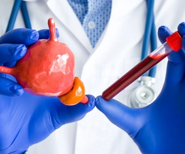Nghiên cứu của Mỹ nhấn mạnh tầm quan trọng của tầm soát ung thư tuyến tiền liệt