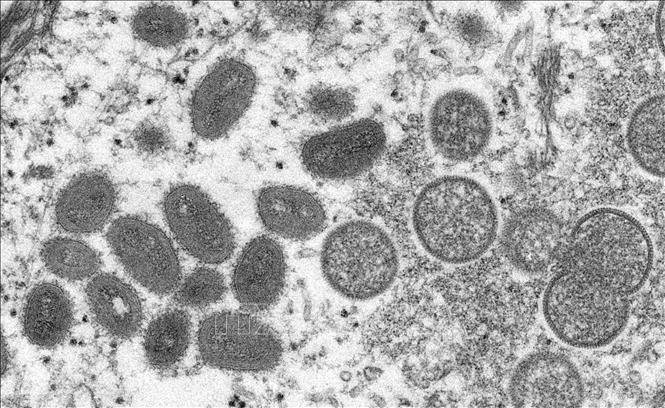 Hình ảnh virus đậu mùa khỉ dưới kính hiển vi điện tử. Ảnh: AFP/TTXVN 