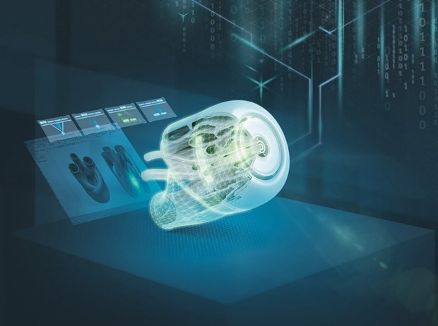 Ảnh minh họa.(Nguồn: Siemens)
