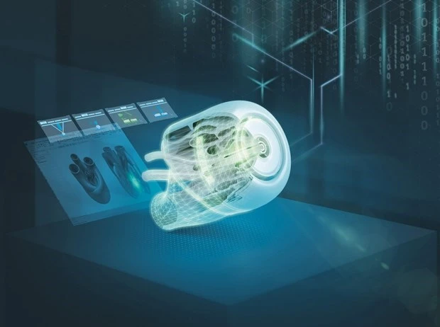 Ảnh minh họa.(Nguồn: Siemens)