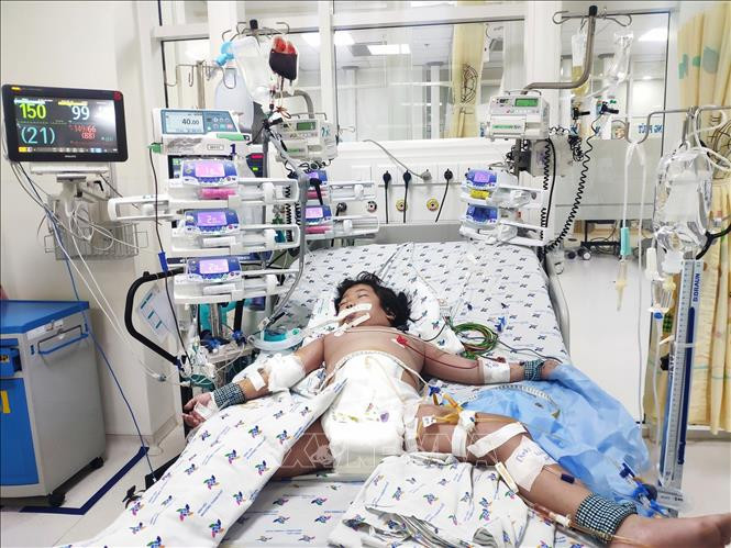 Bệnh nhi sốc sốt xuất huyết nặng được hỗ trợ bằng nhiều máy móc, thiết bị hiện đại tại Bệnh viện Nhi đồng Thành phố. Ảnh: TTXVN phát Thành phố Hồ Chí Minh: Liên tiếp cứu sống hai bệnh nhi sốc sốt xuất huyết nặng ảnh 2