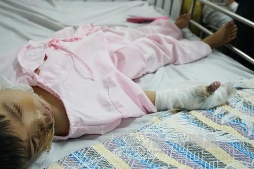 Bệnh nhi Trần Tiến Phước (5 tuổi, quê Kiên Giang) với các vết thương. Ảnh: Phương Vy-TTXVN. Bệnh nhi Trần Tiến Phước (5 tuổi, quê Kiên Giang) với các vết thương. Ảnh: Phương Vy-TTXVN.