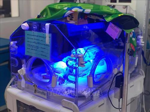 Bệnh nhi đang được chăm sóc đặc biệt tại Khoa Hồi sức sơ sinh của Bệnh viện Nhi đồng Thành phố Hồ Chí Minh. Ảnh: TTXVN phát