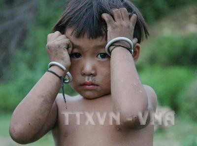 Đôi mắt thơ ngây của em bé Đan Lai... Ảnh tư liệu: Phương Hoa – TTXVN Đôi mắt thơ ngây của em bé Đan Lai... Ảnh tư liệu: Phương Hoa – TTXVN