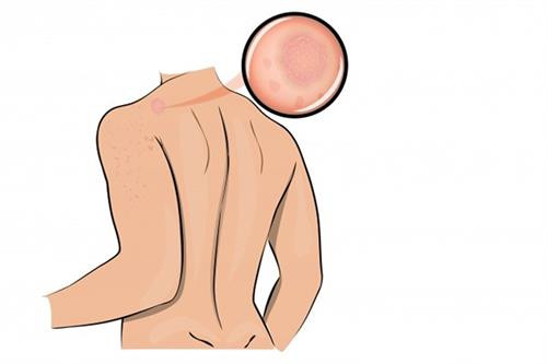 10 dấu hiệu cơ thể cho biết bạn đang bị căng thẳng ảnh 1