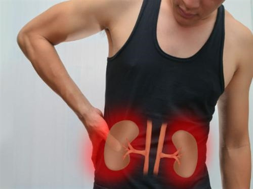 Triệu chứng của bệnh sỏi thận thường không rõ ràng Triệu chứng của bệnh sỏi thận thường không rõ ràng