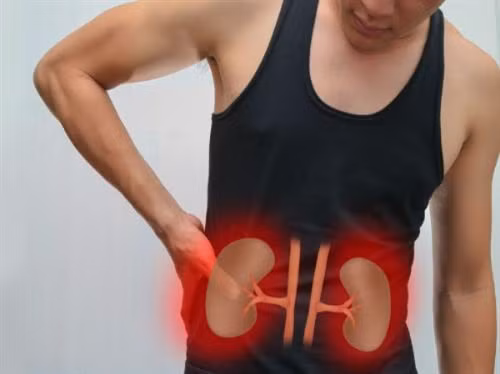 Triệu chứng của bệnh sỏi thận thường không rõ ràng