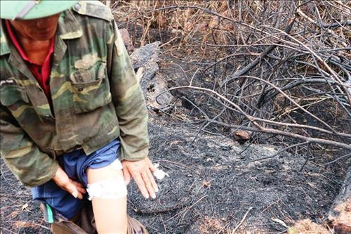 Ông Tiến bị thương ở đùi và tay khi làm đường băng. Ảnh: Hoàng Ngà - TTXVN Ông Tiến bị thương ở đùi và tay khi làm đường băng. Ảnh: Hoàng Ngà - TTXVN