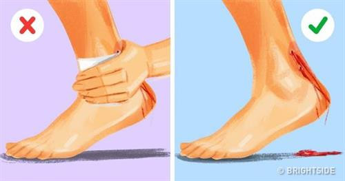 Nơi bị rắn độc cắn sẽ rất đau đớn, máu nhanh chóng chuyển thành đỏ thẫm, thậm chí còn pha một chút xanh. Sau đó vết thương sẽ sưng phồng còn nạn nhân bắt đầu xuất hiện các triệu chứng: đau đầu, sốt, mờ mắt, buồn nôn... Tất cả các bác sĩ đều khuyên rằng lúc này bạn không nên hút máu độc ra, vì nếu miệng lúc đó đang bị thương, độc tố có thể tiếp cận não bộ nhanh hơn. Thay vào đó, nên tìm đến bệnh viện hoặc cơ sở y tế gần nhất để thực hiện chữa trị. Tuy nhiên, nếu như bị cắn ở giữa nơi heo hút không có người, lựa chọn duy nhất của bạn là hút máu độc. Trong trường hợp buộc phải hút, bạn nên thực hiện điều đó càng sớm càng tốt, sau đó súc miệng thật sạch sẽ. Ngoài ra, không được bịt chặt vết thương, vì nếu độc tập trung tại một chỗ, khu vực ấy gần như chắc chắn sẽ bị hoại tử. Hãy để máu chảy, nó sẽ mang theo một phần độc tố ra ngoài. Nơi bị rắn độc cắn sẽ rất đau đớn, máu nhanh chóng chuyển thành đỏ thẫm, thậm chí còn pha một chút xanh. Sau đó vết thương sẽ sưng phồng còn nạn nhân bắt đầu xuất hiện các triệu chứng: đau đầu, sốt, mờ mắt, buồn nôn... Tất cả các bác sĩ đều khuyên rằng lúc này bạn không nên hút máu độc ra, vì nếu miệng lúc đó đang bị thương, độc tố có thể tiếp cận não bộ nhanh hơn. Thay vào đó, nên tìm đến bệnh viện hoặc cơ sở y tế gần nhất để thực hiện chữa trị. Tuy nhiên, nếu như bị cắn ở giữa nơi heo hút không có người, lựa chọn duy nhất của bạn là hút máu độc. Trong trường hợp buộc phải hút, bạn nên thực hiện điều đó càng sớm càng tốt, sau đó súc miệng thật sạch sẽ. Ngoài ra, không được bịt chặt vết thương, vì nếu độc tập trung tại một chỗ, khu vực ấy gần như chắc chắn sẽ bị hoại tử. Hãy để máu chảy, nó sẽ mang theo một phần độc tố ra ngoài.