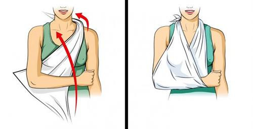 Những kỹ năng cứu người đơn giản nhưng ai cũng cần phải biết ảnh 6 Những kỹ năng cứu người đơn giản nhưng ai cũng cần phải biết ảnh 6