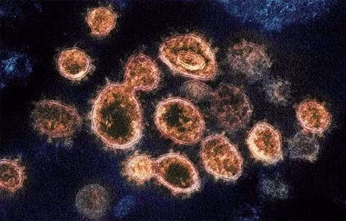 Nghiên cứu mới cho thấy SARS-CoV-2 dễ bám vào tế bào gấp 1.000 lần so với virus SARS. Ảnh: Flickr