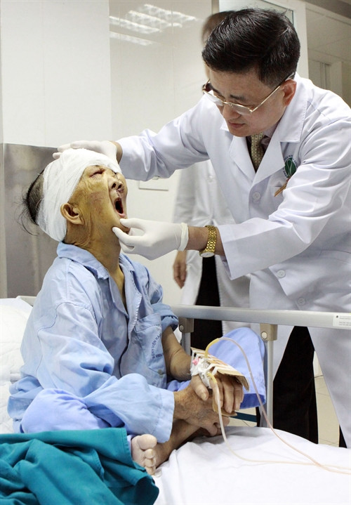 Bac sỹ kiểm tra sức khỏe của bệnh nhân Triều Mù Chài,sau khi phẫu thuật cắt bỏ khối u khổng lồ trên mặt. Ảnh: Dương Ngọc- TTXVN.