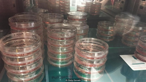 Chế tạo thành công não người mini ảnh 1