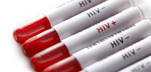 UNAIDS ngày 5/3 cho biết, một người đàn ông dương tính với HIV được điều trị khỏi bệnh là rất đáng khích lệ. Ảnh: healthnews.ng UNAIDS ngày 5/3 cho biết, một người đàn ông dương tính với HIV được điều trị khỏi bệnh là rất đáng khích lệ. Ảnh: healthnews.ng