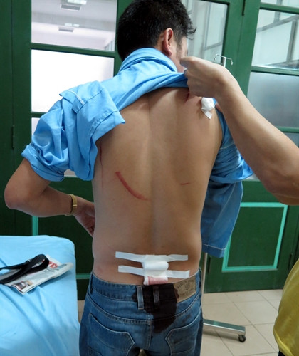 Một nhà báo bị côn đồ truy sát khi đang trên đường đến cơ quan làm việc. ảnh 2 Một nhà báo bị côn đồ truy sát khi đang trên đường đến cơ quan làm việc. ảnh 2