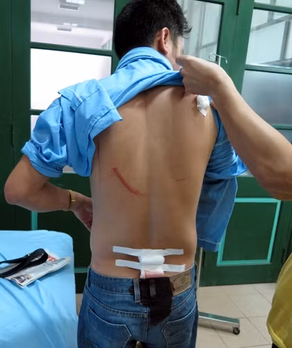 Một nhà báo bị côn đồ truy sát khi đang trên đường đến cơ quan làm việc. ảnh 2