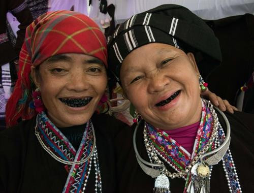 Đôi bạn răng đen. Đôi bạn răng đen.