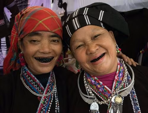 Đôi bạn răng đen.