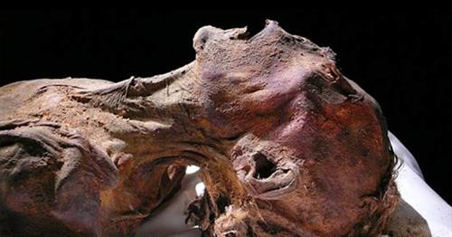 Nguyên nhân cái chết của Vua Tutankhamun: Vua Tutankhamun là một trong những vị pharaoh nổi tiếng của Ai Cập dù qua đời khi còn trẻ. Theo ảnh chụp X-quang và chụp cắt lớp CT xác ướp, nhà vua bị thương khá nặng ở xương sườn và bị gãy một chân. Điều này dẫn tới kết luận rằng nhà vua chết do bị một xe ngựa đâm phải. Ảnh: MomJunction. Tuy nhiên, nhiều giả thuyết khác đã được đưa ra. Nguyên nhân cái chết của Vua Tutankhamun có thể là từ một cú đá của ngựa kéo xe, hay thậm chí từ một vụ tấn công của hà mã. Một số xương sườn của nhà vua đã biến mất, có thể là do vụ tai nạn, cũng có thể là do bị bọn trộm mộ cắt bỏ để lấy đá quý trong lồng ngực. Ảnh: The Independent. Một giả thuyết thú vị khác của giáo sư Albert Zink dựa trên hơn 2.000 bản quét máy tính và kiểm tra ADN của dòng họ Tutankhamun cho thấy tai nạn xe ngựa là điều khó có thể xảy ra. Lý do là nhà vua bị khoèo chân bẩm sinh. Giáo sư cho rằng Vua Tutankhamun chết trẻ là do cơ thể yếu ớt bẩm sinh (kết quả của hôn nhân nội tộc). Bên cạnh đó, nhà vua còn mắc sốt rét. Tuy nhiên, ngay cả giáo sư Zink cũng thừa nhận ông không thể chắc chắn đó là nguyên nhân vua qua đời. Đến nay, điều này vẫn còn là một bí ẩn. Ảnh: Ancient Origins. Tên gốc của nhân sư: Suốt nhiều thế kỷ, tượng nhân sư bị chôn vùi dưới cát. Cho tới năm 1817, đầu tượng mới nhô ra khỏi cát. Nhờ nhà khảo cổ Mark Lehner, chúng ta đã biết ai dựng tượng (Pharaoh Khafre), cách xây dựng và thời gian xây dựng (ít nhất ba năm). Ngoài những điều này, tất cả về nhân sư đều còn là dấu hỏi. Ảnh: World-mysteries. Trước hết, chúng ta không biết người Ai Cập cổ gọi biểu tượng này là gì. “Sphinx” (nhân sư) là một thuật ngữ tiếng Hy Lạp chưa tồn tại vào thời Pharaoh Khafre xây dựng công trình này. Ngoài ra, ý nghĩa thực sự của nhân sư cũng chưa được làm rõ. Thần Ruti của Ai Cập cổ có hình dạng như hai con sư tử gắn liền ở lưng, bảo vệ lối vào thế giới bên kia. Điều này nghe khá giống nhân sư, nhưng bức tượng thiếu đi chiếc đầu thứ hai để có thể khẳng định giả thuyết này. Ảnh: Truth Control. Xác ướp đau khổ: Xác ướp có mồm mở ra như đang hét lên không phải điều hiếm gặp. Đây là kết quả của nghi lễ đặc biệt giúp các linh hồn ăn, uống và thở dễ dàng hơn khi qua thế giới bên kia. Tuy nhiên, xác ướp có tên "Unknown Man E" được phát hiện năm 1886 gây ấn tượng mạnh do có vẻ như đang thét lên trong đau đớn. Một số nhà nghiên cứu cho rằng người đàn ông này đã bị đầu độc hoặc chôn sống. Số khác cho rằng đây là một hoàng tử người Hittite bị giết. Ảnh: Ancient Origins. Một giả thuyết khác cho rằng đây có thể là Hoàng tử Pentewere, người bị xử tử do lên kế hoạch ám sát vua cha mình - Pharaoh Ramses III. Đó có thể là lý do vì sao xác ướp bị bọc trong da cừu - dấu hiệu cho thấy người chết đã làm điều xấu xa. Đồng thời, người này không có bia mộ, như thế anh ta không thể sang thế giới bên kia - sự trừng phạt tồi tệ nhất với người Ai Cập cổ. Não của anh ta vẫn ở trong hộp sọ, xác không được làm khô, và nhựa cây được đổ vào họng thay vì trong sọ. Tuy nhiên, đây chỉ là một giả thuyết và chưa có bằng chứng xác thực. Ảnh: Daily Mail. Số phận của Nữ hoàng Nefertiti: Ngoài Cleopatra, khó có phụ nữ Ai Cập cổ nào nổi tiếng hơn Nữ hoàng Nefertiti. Bà trị vì cạnh Pharaoh Akhenaten suốt nhiều năm trời, cho tới khi đột ngột biến mất. Sau năm 1336 trước Công nguyên, các ghi chép đều không hề nhắc tới chuyện gì đã xảy ra với bà. Chúng ta cũng chưa tìm thấy lăng mộ hay xác ướp của Nữ hoàng. Ảnh: CNN. Số buồng trong Đại kim tự tháp Giza: Đến nay, chúng ta vẫn chưa biết bên trong kỳ quan cổ đại này có những gì ngoài ba buồng chính của vua, nữ hoàng và sảnh lớn. Gần đây, các nhà khoa học đã áp dụng nhiều phương pháp tiên tiến và phát hiện ra một số buồng mới trong kim tự tháp. Ảnh: ScienceAlert. Từ năm 1993, nhiều robot nhỏ đã được đưa vào trong kim tự tháp để khám phá. Chúng đem lại những hình ảnh về các đường hầm bí ẩn chưa từng được phát hiện. Những đường hầm này quá nhỏ cho các mục đích sử dụng thông thường. Tuy nhiên, chúng cho thấy vẫn còn nhiều điều bí ẩn trong kim tự tháp hơn ta tưởng. Ảnh: History. Hải tộc: Theo bách khoa lịch sử cổ đại Ai Cập, hải tộc là nhóm cướp biển tung hoành khắp Địa Trung Hải. Một trong những mục tiêu chính của chúng là Ai Cập. Ngoài một vài dòng mô tả ngắn gọn, sử sách của Ai Cập không nhắc gì đến những kẻ xâm lăng từ biển này. Tài liệu thời Ramses II có nhắc tới hải tộc. Nhóm người này liên kết với dân Hittite nhưng cũng là lính đánh thuê của Vua Ramses. Ảnh: Pinterest. Người được chôn ở Qurna: Năm 1908, nhà Ai Cập học Flinders Petrie phát hiện ra một khu lăng mộ hoàng gia. Hai quan tài trong mộ có niên đại trước thời vua Tut khoảng 250 năm. Một xác ướp là phụ nữ và một xác ướp là trẻ em, có thể là con của người phụ nữ này. Cả hai đều đeo trang sức bằng vàng và ngà voi, thể hiện tầm quan trọng của họ. Tuy nhiên, các mô tả trong mộ về thân phận của họ đã bị hư hại nặng, chỉ biết rằng đây là nơi chôn vợ của vua. Ảnh: Artnetnews.