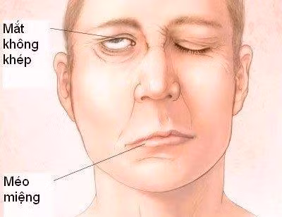 Cẩn thận biến dạng khuôn mặt vì cơn gió lạnh đầu mùa ảnh 1