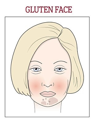 Thói quen ăn uống làm hại da mặt ảnh 5