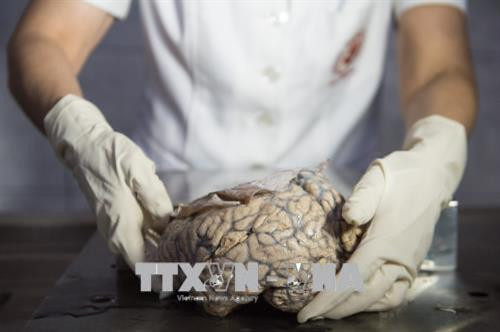 Một bộ não con người được trưng bày tại một bảo tàng ở Lima, Peru. Ảnh: AFP/TTXVN. Một bộ não con người được trưng bày tại một bảo tàng ở Lima, Peru. Ảnh: AFP/TTXVN.