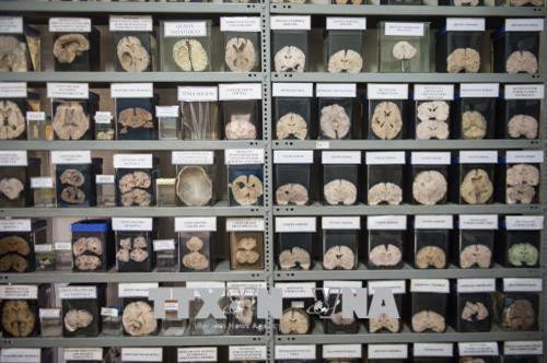 Bộ sưu tập não bộ con người được trưng bày tại một bảo tàng ở Lima, Peru. Ảnh: AFP/TTXVN. Bộ sưu tập não bộ con người được trưng bày tại một bảo tàng ở Lima, Peru. Ảnh: AFP/TTXVN.