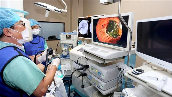 Ekip Bệnh viện Trung ương Huế phối hợp Liên Chi hội Nội soi Tiêu hóa Việt Nam triển khaikỹ thuật tán sỏi đường mật trong gan bằng laser qua hệ thống nội soi đường mật qua miệng (Spyglass). Ảnh: TTXVN phát Lần đầu thực hiện kỹ thuật tán sỏi đường mật trong gan bằng laser tại miền Trung- Tây Nguyên ảnh 2