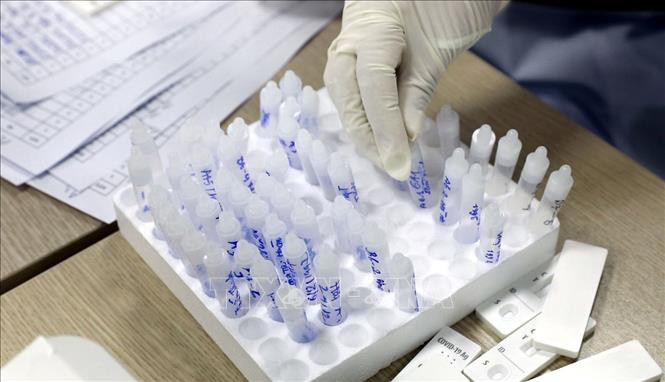 Bổ sung phương pháp test nhanh kháng nguyên hỗ trợ giám sát, dịch COVID-19