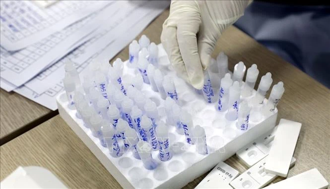 Bổ sung phương pháp test nhanh kháng nguyên hỗ trợ giám sát, dịch COVID-19