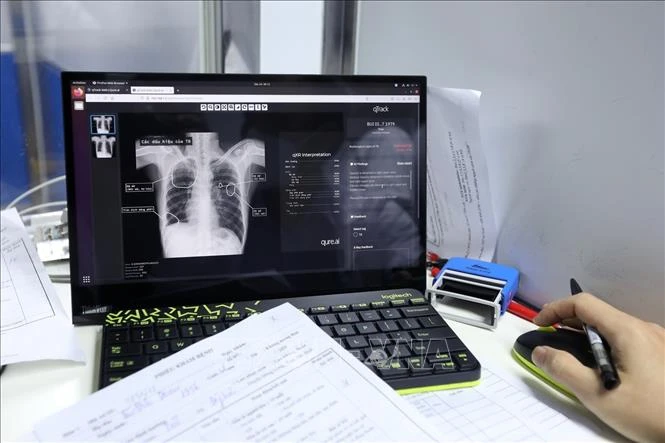 Số bệnh nhân lao phổi mới có bằng chứng vi khuẩn giảm mạnh