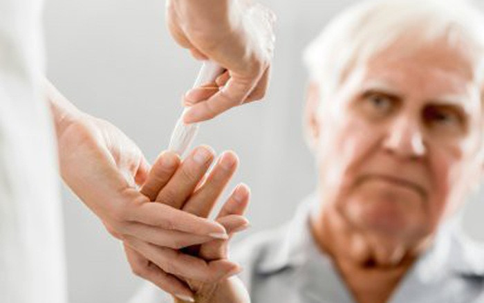 Có thể xét nghiệm máu để dự báo nguy cơ mắc bệnh Alzheimer 
